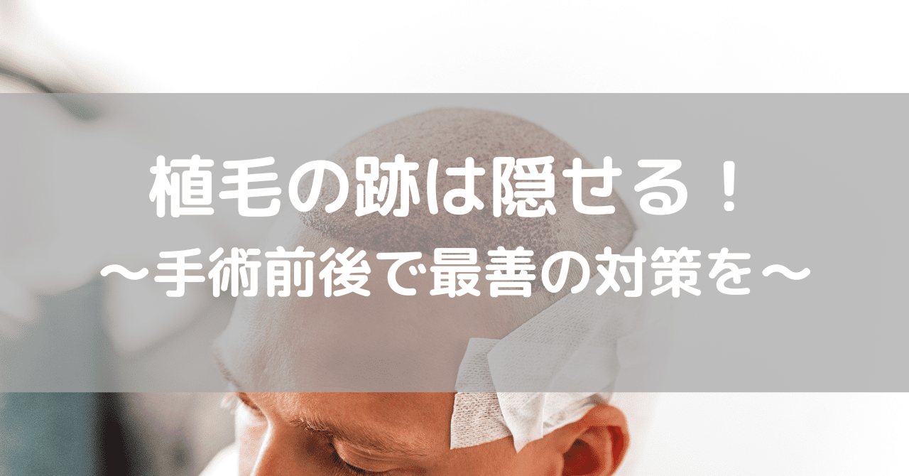 植毛の跡は隠せる 手術前後で最善の対策を