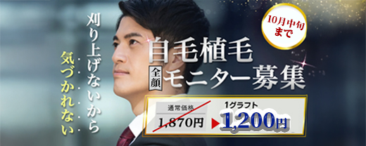 自毛植毛モニター募集