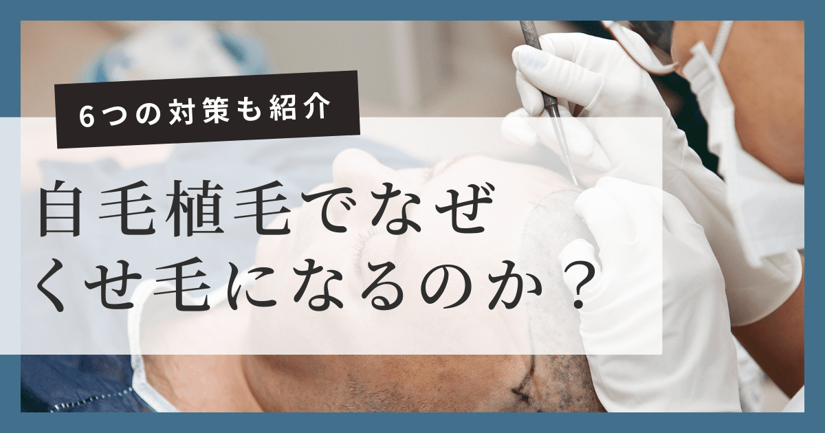 自毛植毛でくせ毛になるのはなぜ？知っておきたい6つの対策とは｜東京 自毛植毛 アルモ形成クリニック 美容外科