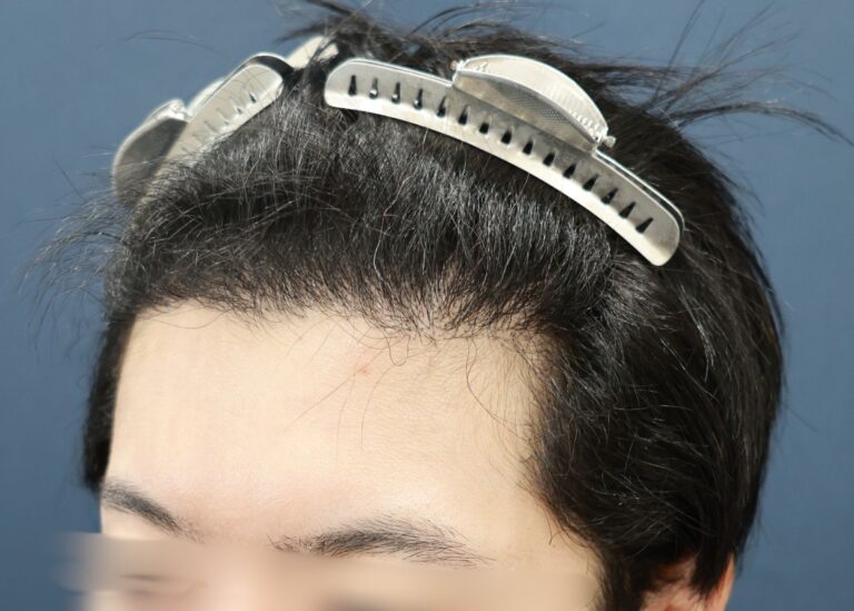 症例写真