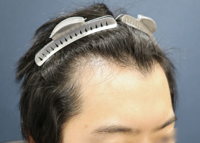 症例写真