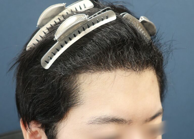 症例写真