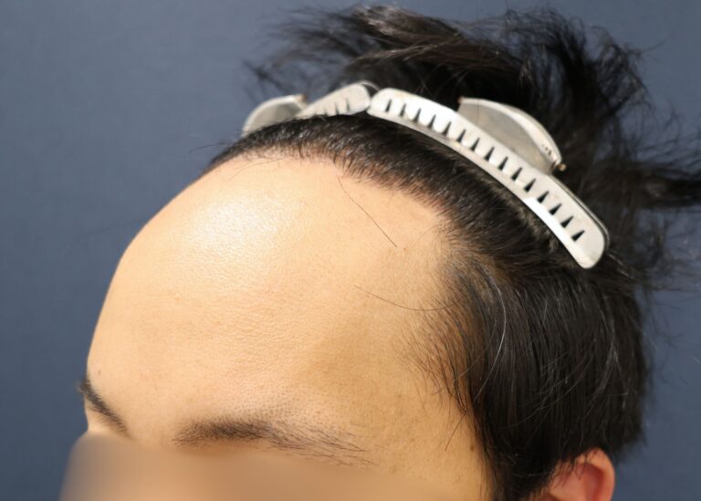 症例写真