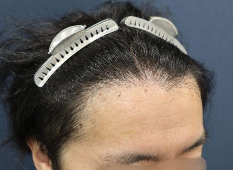 症例写真