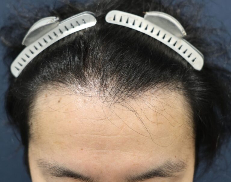 症例写真