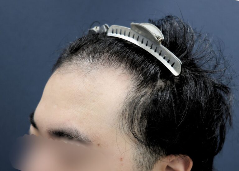 症例写真