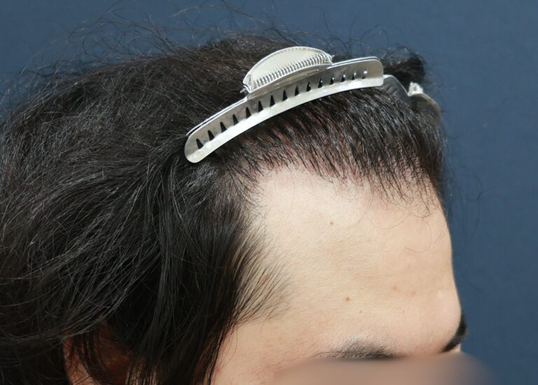 症例写真