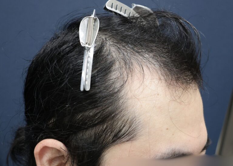 症例写真