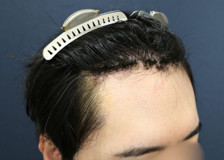 症例写真