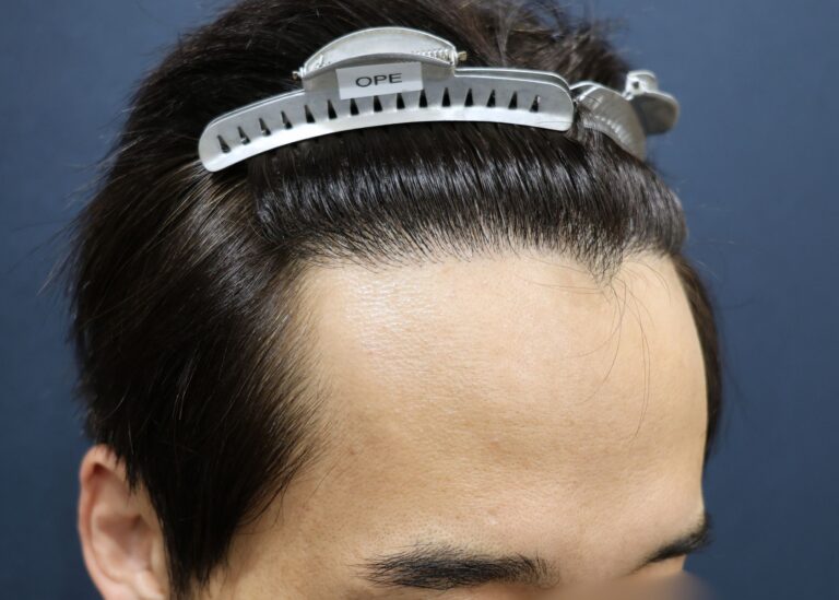 症例写真