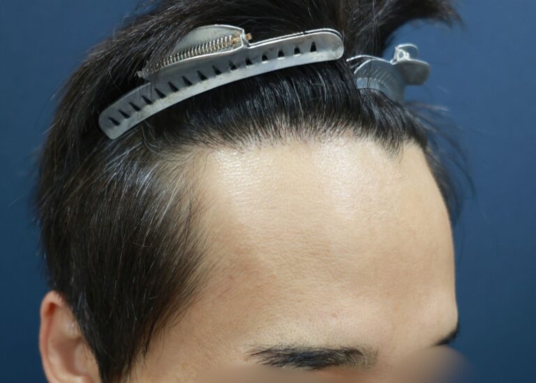 症例写真