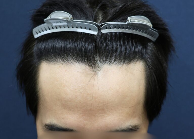 症例写真