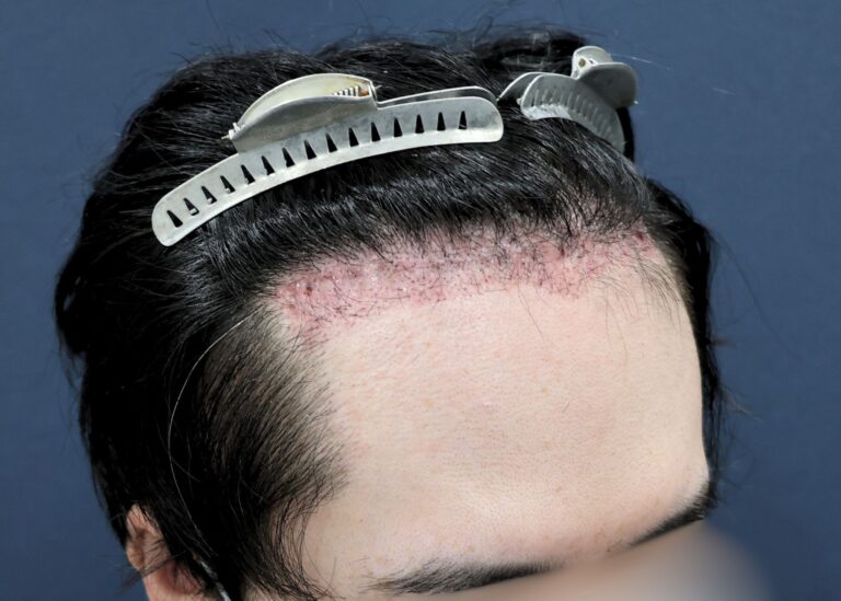 症例写真