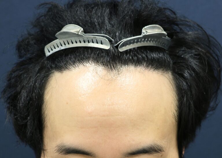 症例写真