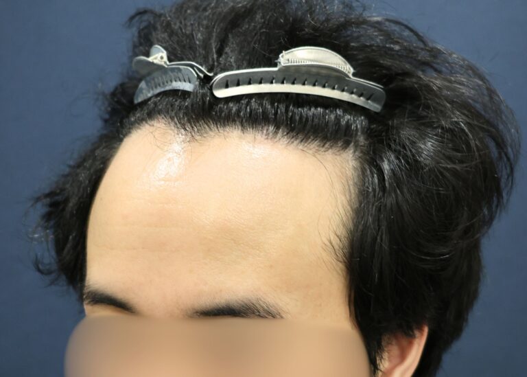 症例写真