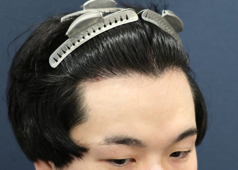 症例写真
