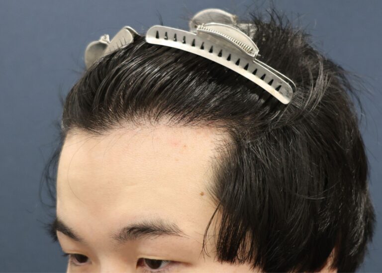 症例写真