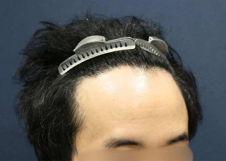 症例写真