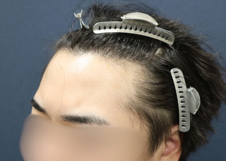 症例写真