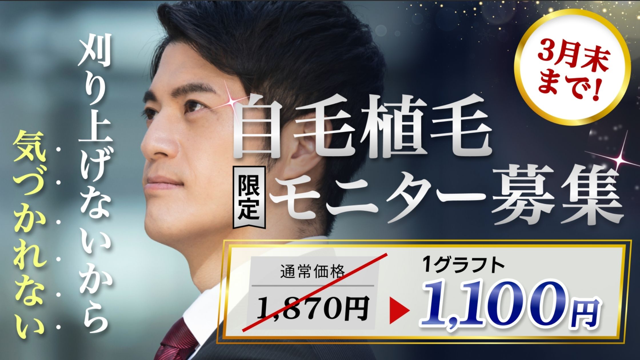 自毛植毛モニター募集2025年3月31日まで