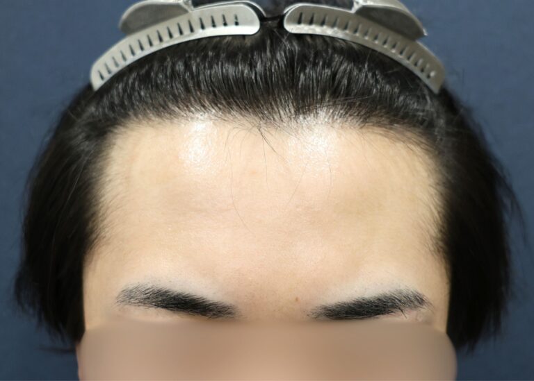 症例写真