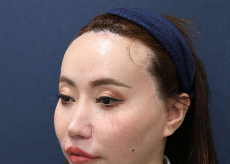 症例写真