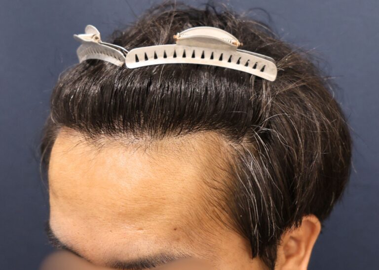 症例写真
