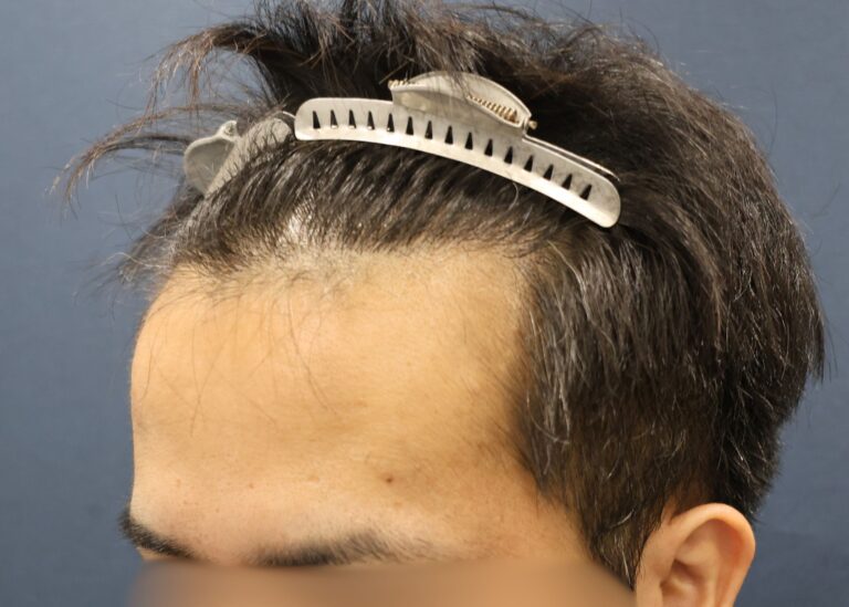 症例写真