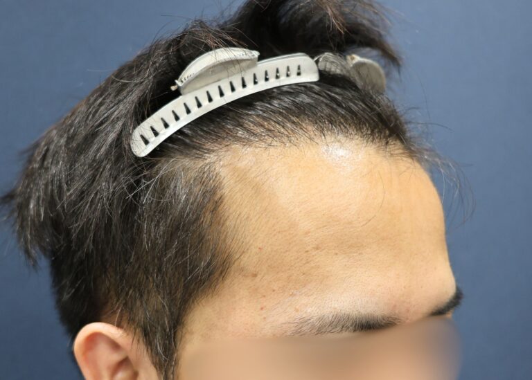 症例写真