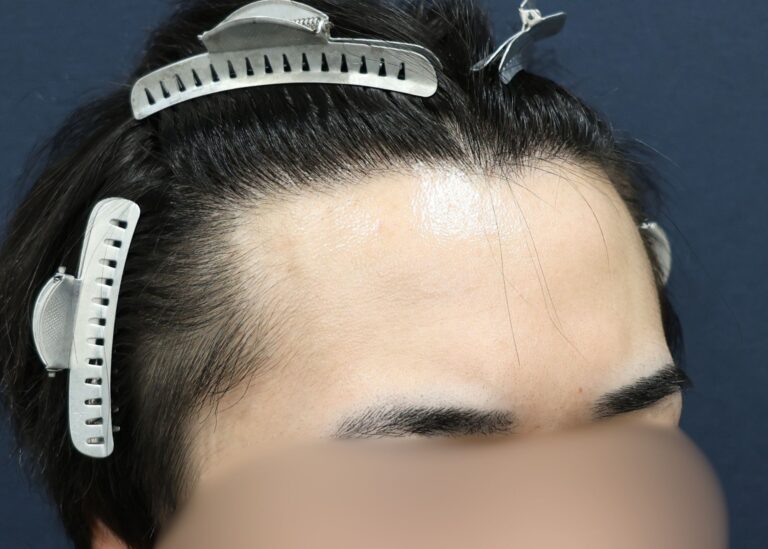 症例写真
