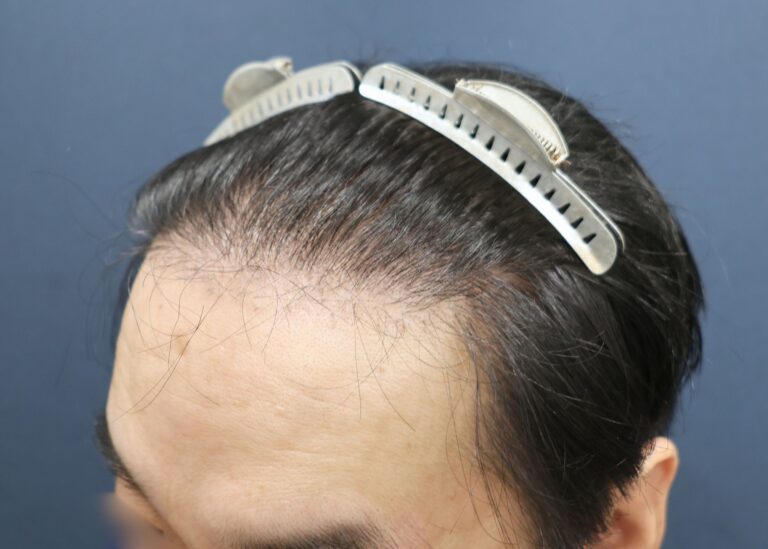 症例写真