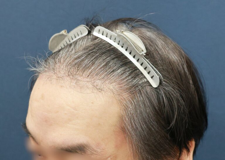 症例写真