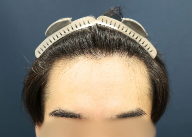 症例写真