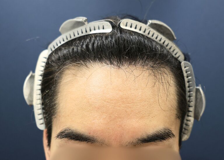 症例写真