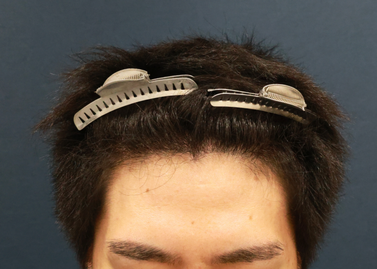 症例写真