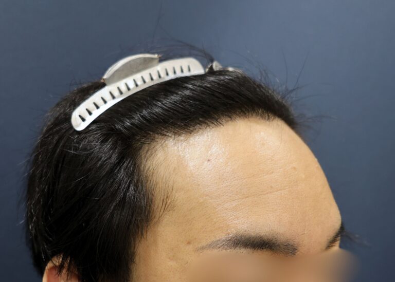 症例写真