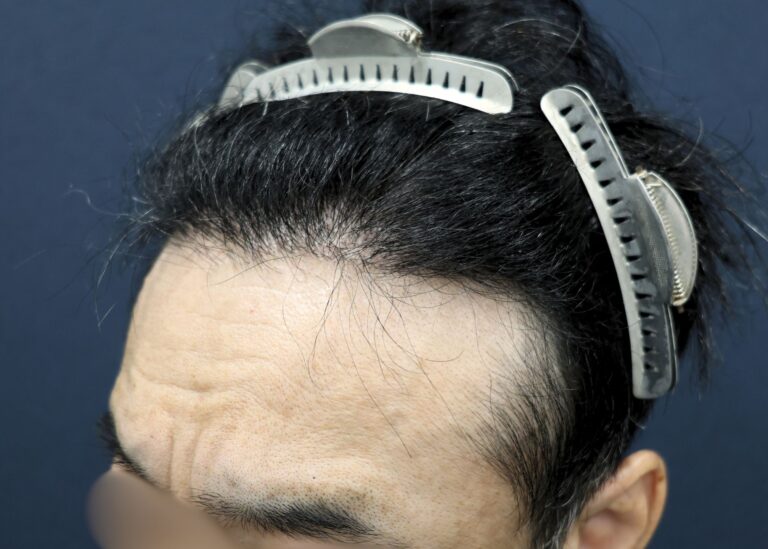 症例写真