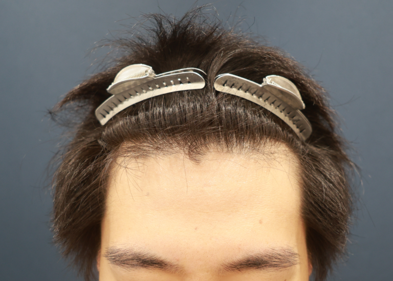 症例写真