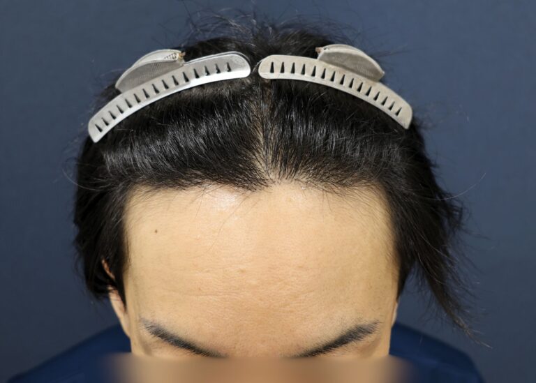 症例写真