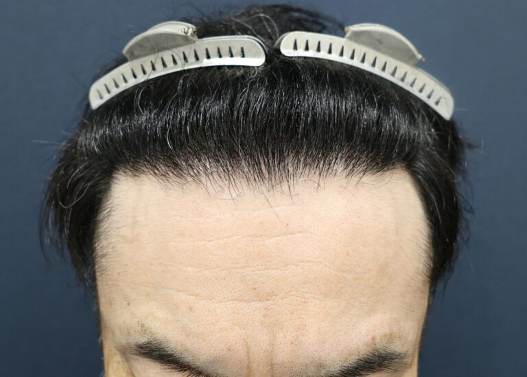 症例写真