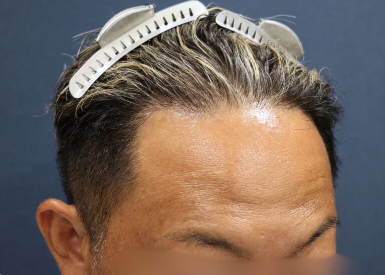 症例写真