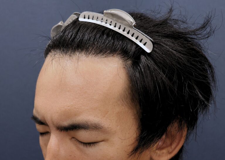 症例写真