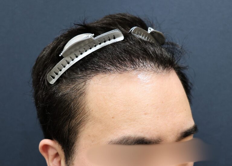 症例写真