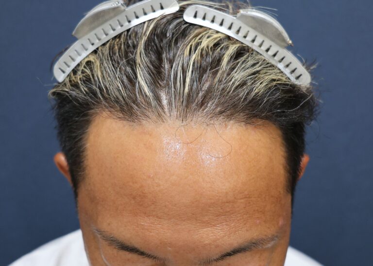 症例写真