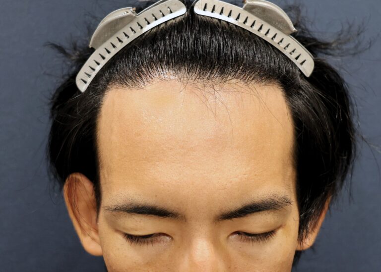 症例写真