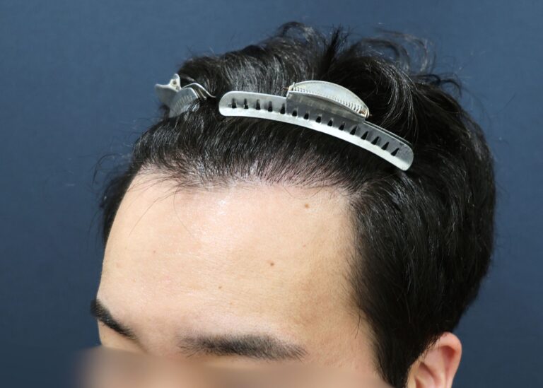 症例写真