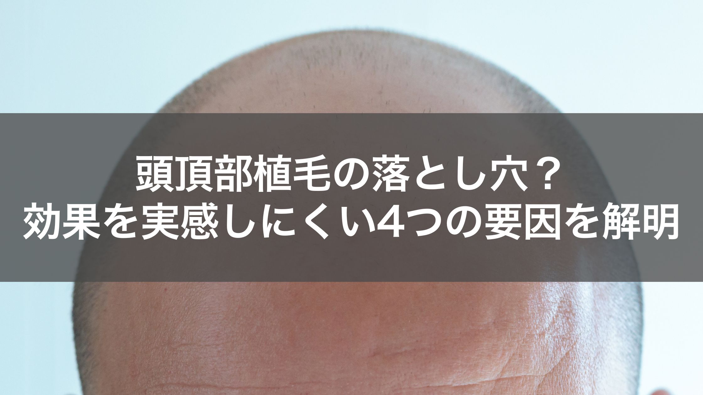 頭頂部の植毛はやめたほうがいい?効果が出にくい・遅い4つの理由