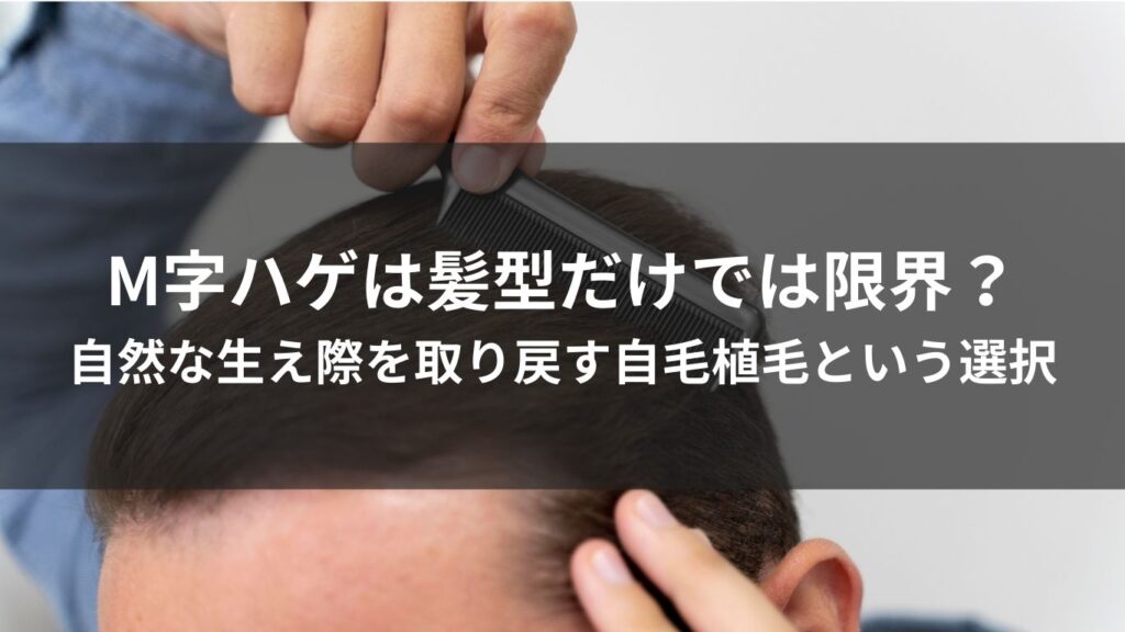 M字ハゲは髪型だけでは限界？自然な生え際を取り戻す自毛植毛という選択