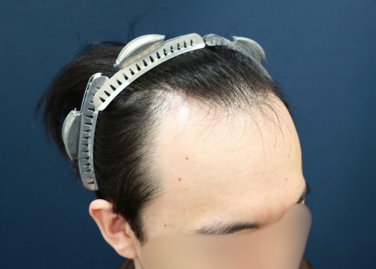 症例写真