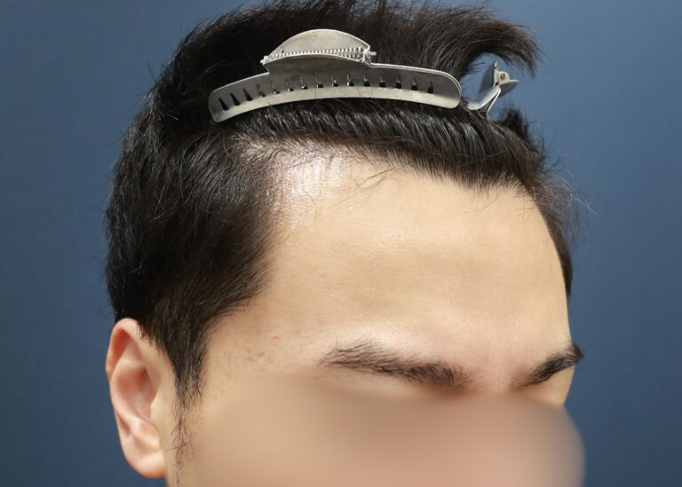 症例写真